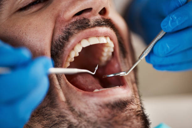 Best Emergency Dental Services for Seniors in Bray, OK